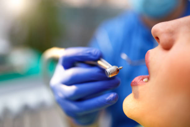 Best Wisdom Tooth Removal  in Gholson, TX